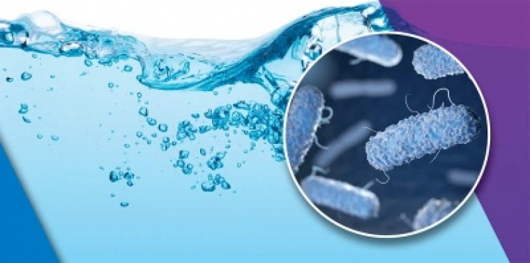 Raginame atlikti Legionella bakterijų daugijimosi prevenciją